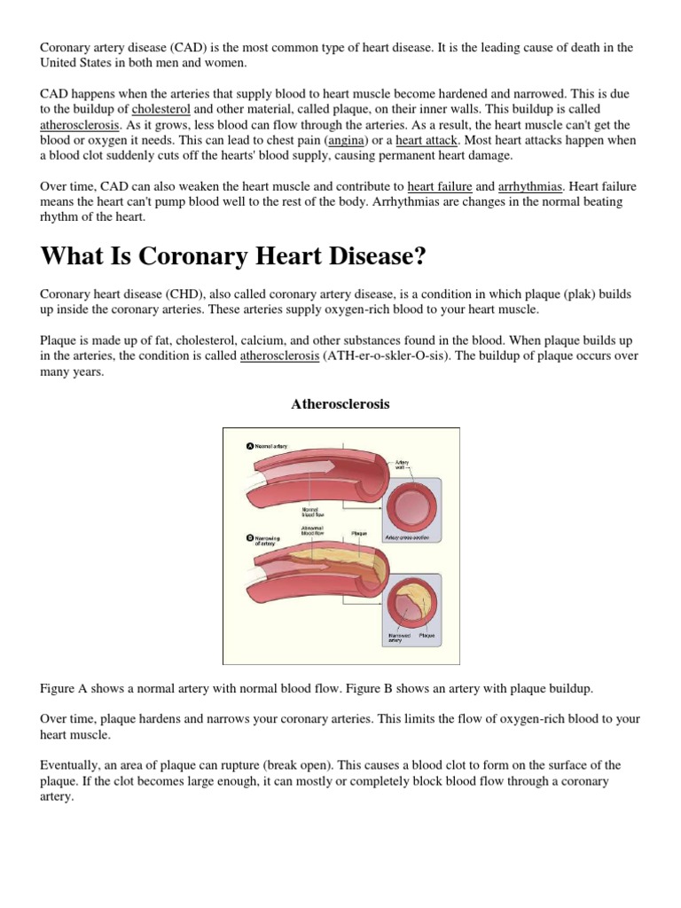 Coronary Artery Disease | PDF | Heart Failure | Coronary Artery Disease