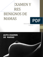 Tumores Benignos de Mama