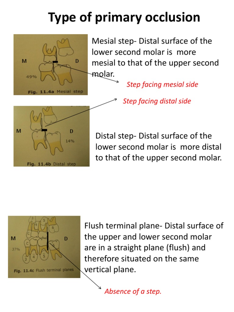 Carey's Analysis Mouth Dentistry Branches