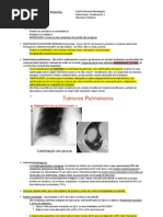 Aula 6 - Tumores de Pulmão