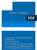 Gastric Carcinoma