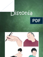 Distonía