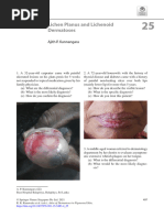 benign penile melanotic macules Bowen's disease of the shaft presenting as a pigmented macule: dermoscopy, reflectance confocal microscopy and histopathological correlation Penile Melanotic Macules - DoveMed