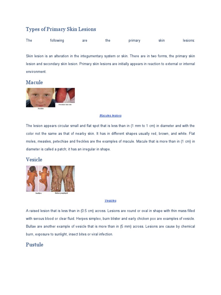 Types of Primary Skin Lesions Explained | PDF | Dehydration | Cutaneous ...
