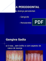 Doença Periodontal