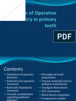 Cavity Preparation in Primary Teeth