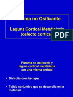 14- Fibroma No Osificante