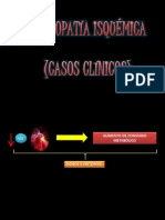 Casos Clinicos Isquemia Miocardio
