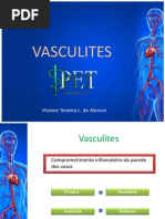 Vasculites 