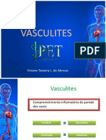 Vasculites 