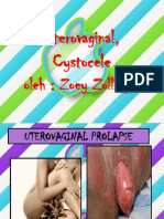 Uterovaginal, Cystocele