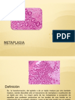 Metaplasia: transformación de tejidos