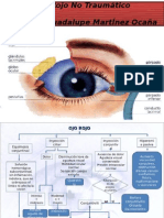 Ojo Rojo No Traumatico (a)