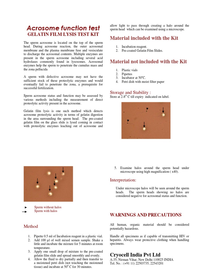 Gelatin Film Lysis Test PDF Sperm Gelatin