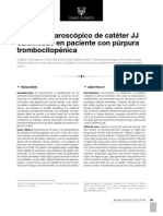 Manejo Laparoscópico de Catéter JJ Calcifcado en Paciente Con Púrpuratrombocitopénica