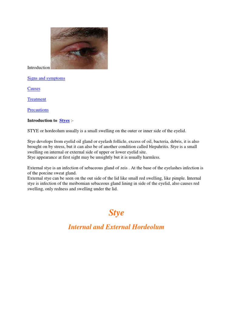 Introduction To STYE PDF Health Sciences Medicine