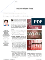 Non Carious Tooth Surface Loss