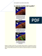 What Are The Late Effects of Polio - En.es