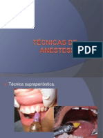 Técnicas de Anestesia