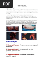 Hemorragia para impressão