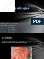 Las Alergias