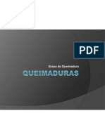 QUEIMADURAS