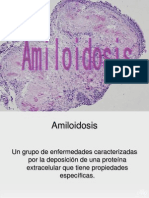 Amiloidosis