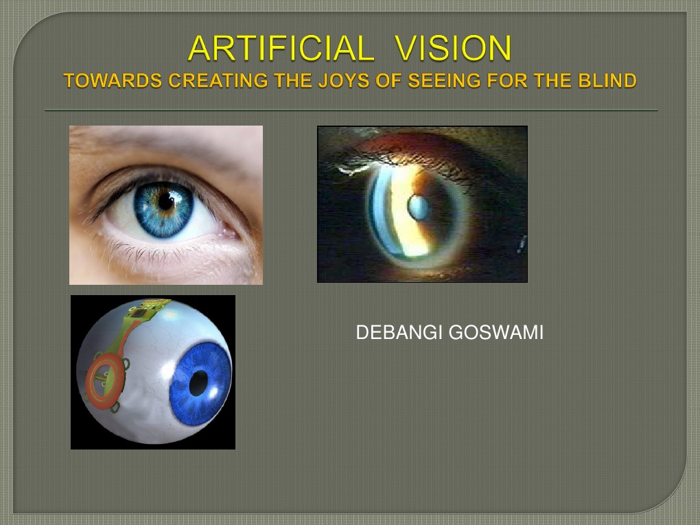 Artificial Vision Technical Ppt Retina Visual System Free 30day