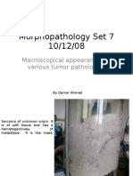 Morphopathology Set 7 10/12/08: Macroscopical Appearances in Various Tumor Pathologies