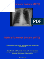 Nódulo+Pulmonar+Solitario+(NPS)