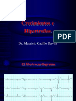 Crecimientos e Hipertrofias