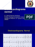 Electrocardiograma Normal