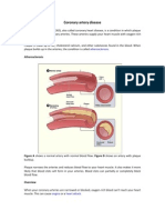 Coronary Artery Disease Vertical Format