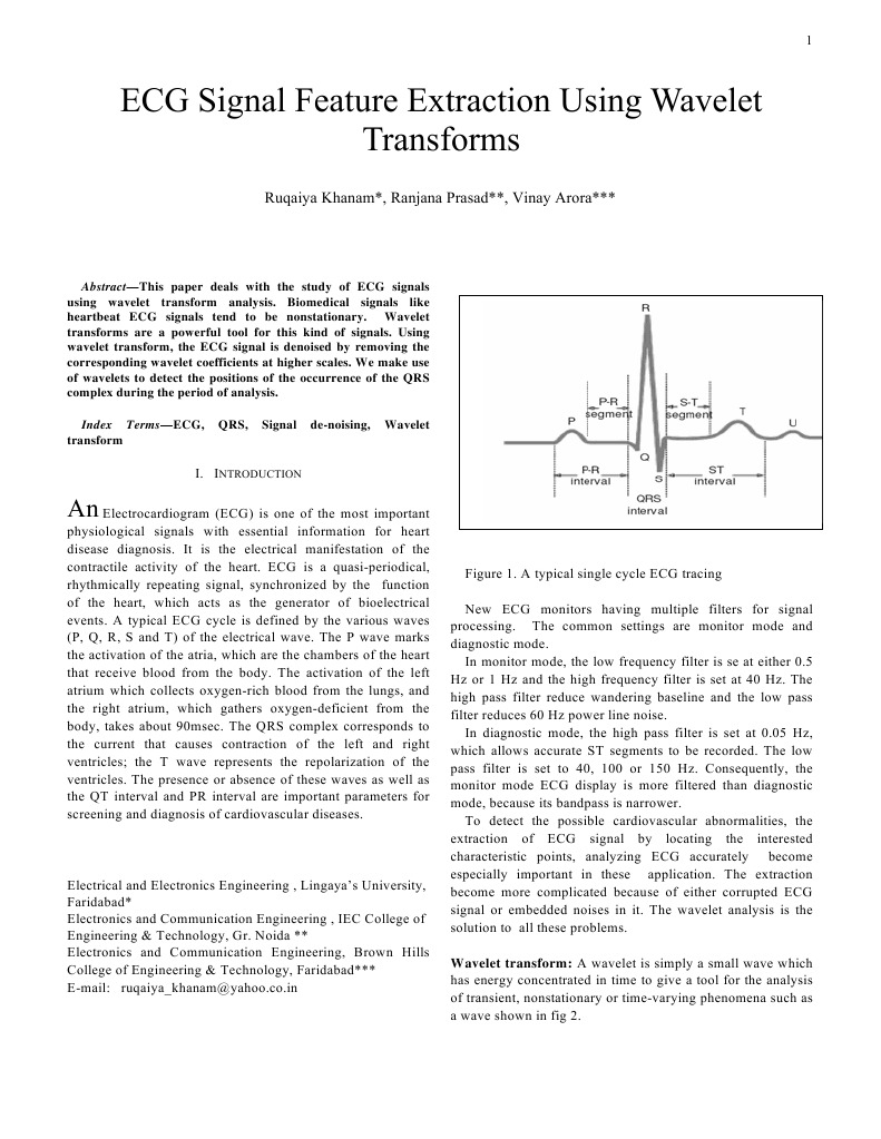ECG Signal Feature Extraction Using Wavelet Transforms: Ruqaiya Khanam ...