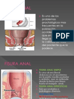 Fisura Anal Nuevo... 1