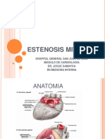 Estenosis Mitral