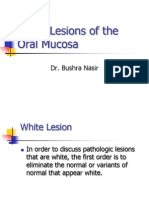 White Lesions of The Oral Mucosa