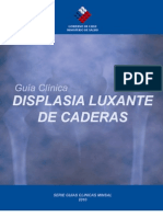 Displasia Luxante de Cadera