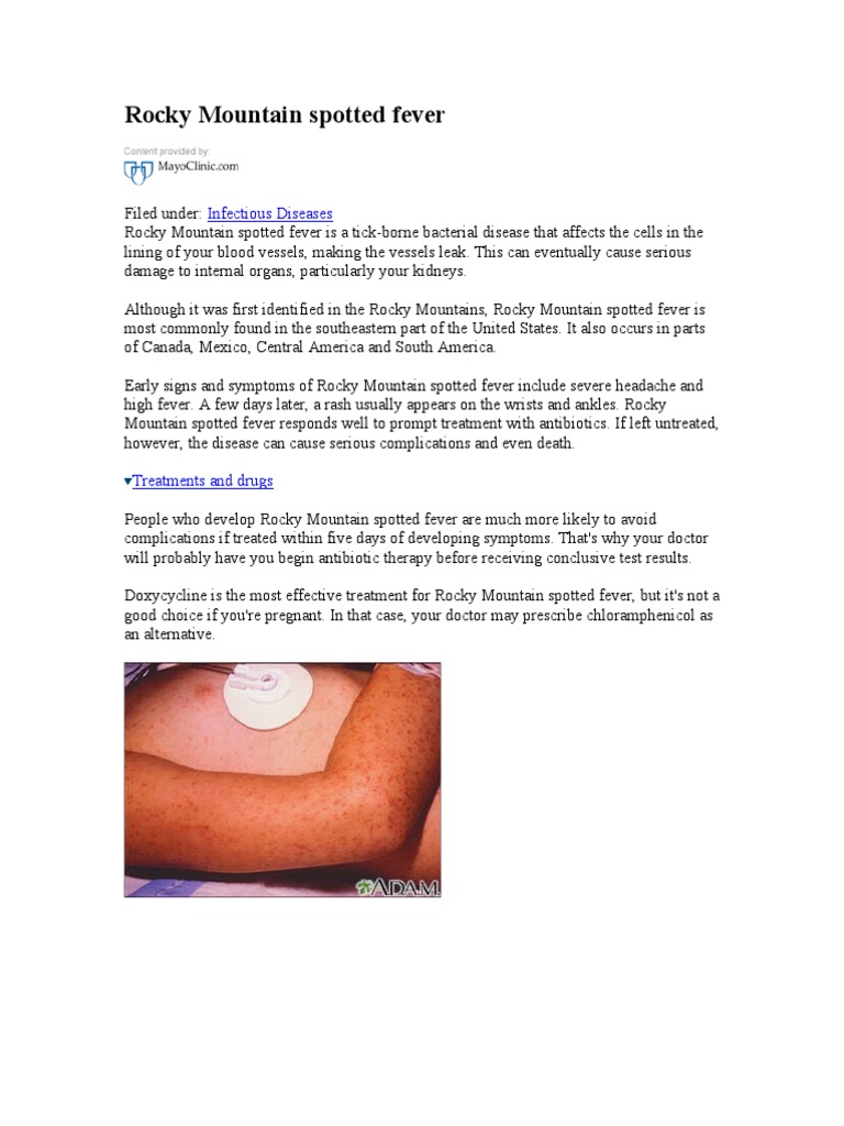 Rocky Mountain Spotted Fever | PDF | Lyme Disease | Medical Specialties