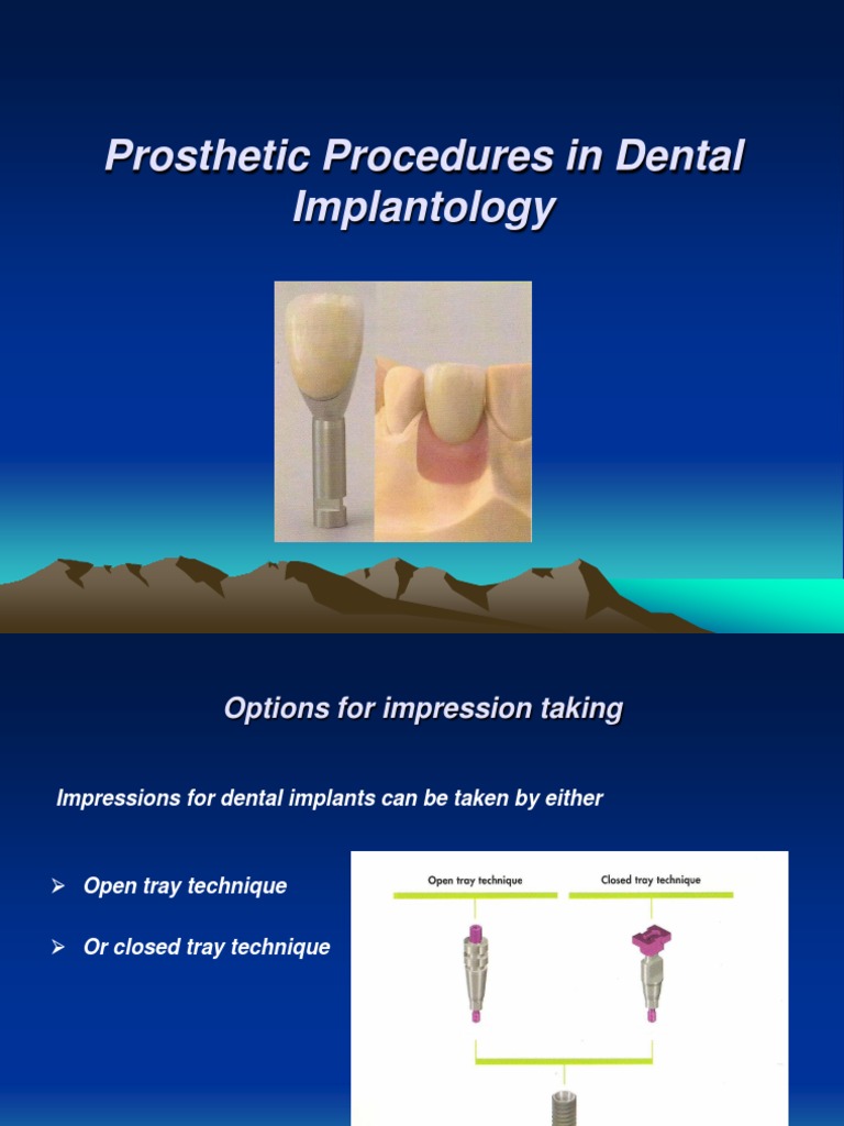 Prosthetic Procedures in Dental Implantology Dental Implant