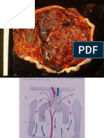 Aula 1 T HIPÓXIA PERINATAL