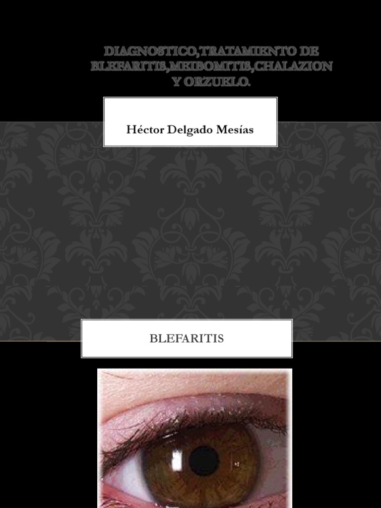 BLEFARITIS | PDF