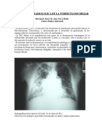 Presentacion Radiologica de La Tuberculosis Miliar