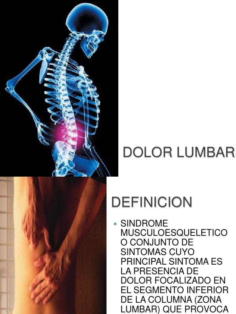 Dolor Lumbar.. | Dolor lumbar | Dolor