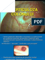 Diverticul Colon