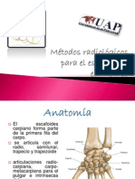 METODO PARA ESCAFOIDES