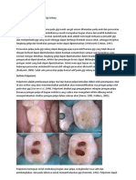 Perawatan Pulpotomi Pada Gigi