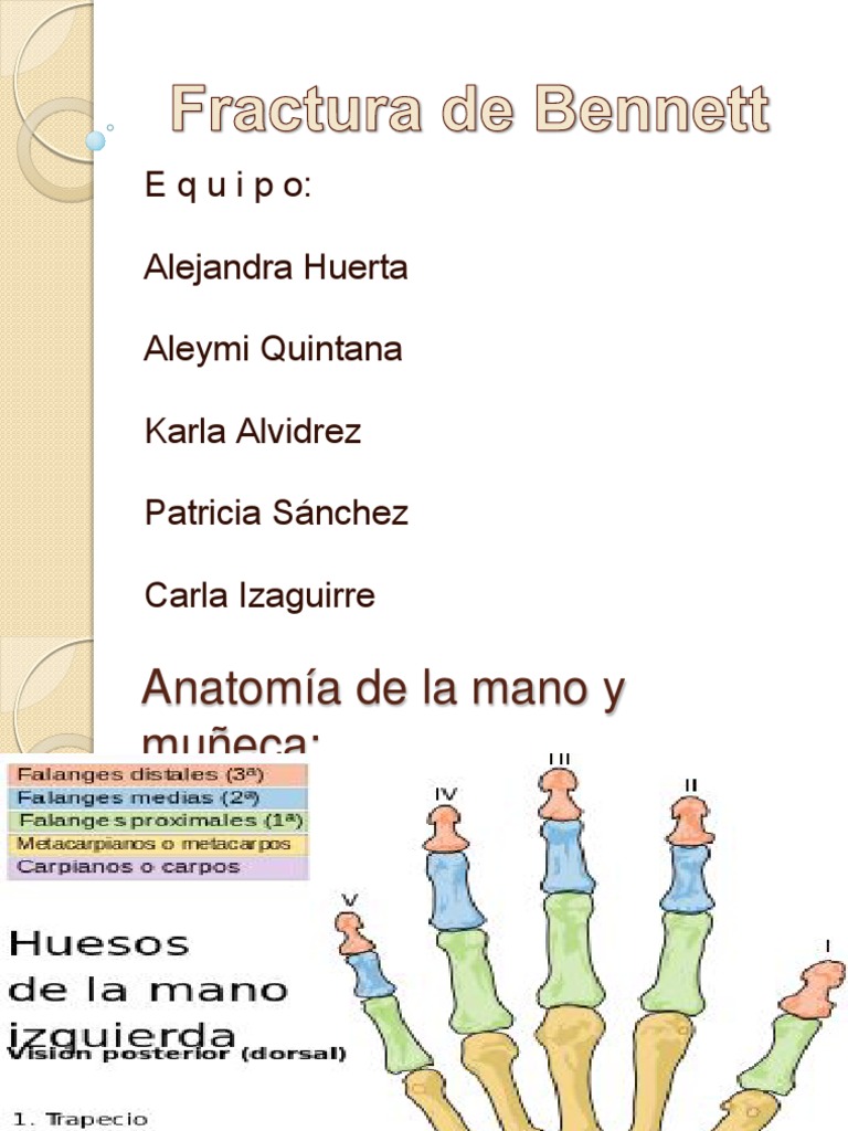 Fractura Mano Lesión Prueba gratuita