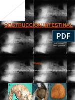 Obstruccion Intestinal