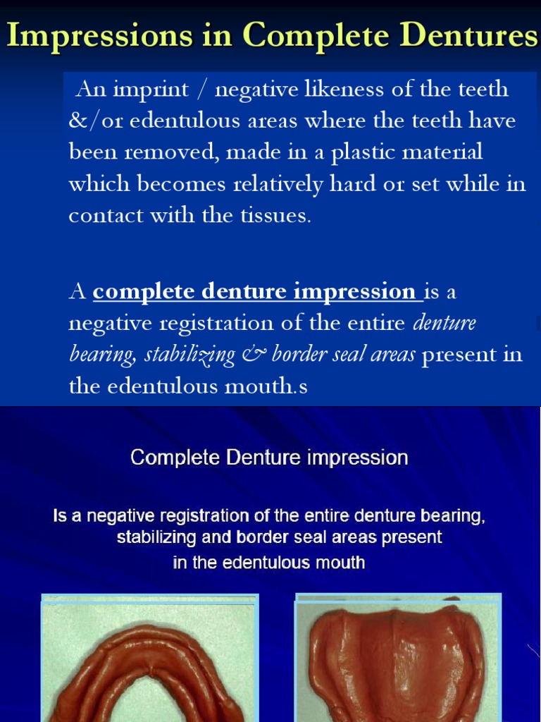 Primary Impression Dentures Nature
